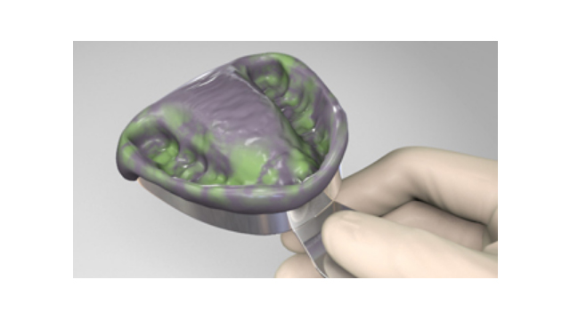 Α-Σιλικόνες - VPS Αποτυπωτικά Υλικά Ακριβείας