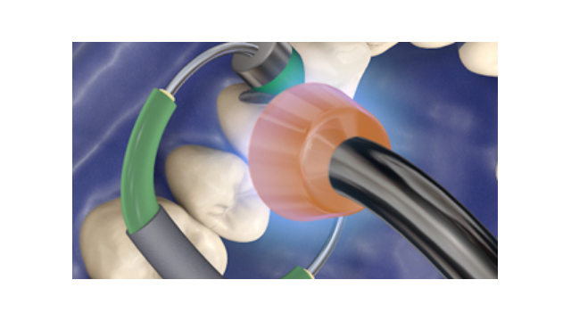 Εξαρτήματα και συσκευές φωτοπολυμερισμού LED