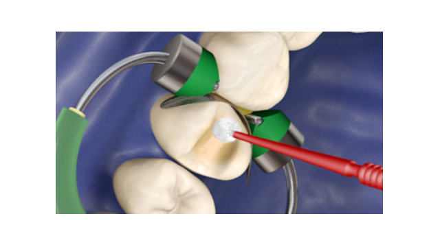 Συγκολλητικοί Παράγοντες