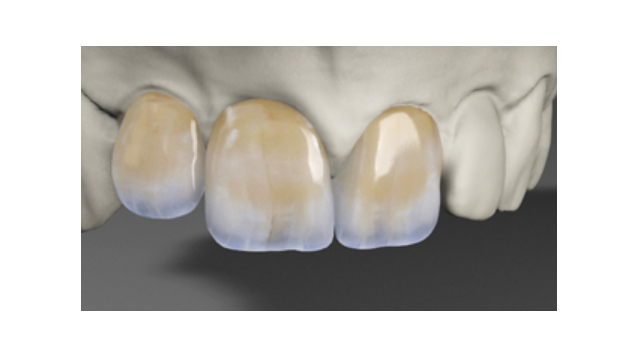 Κεραμικά Υλικά