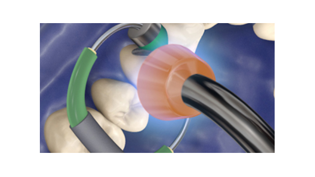 Φωτοπολυμερισμός LED