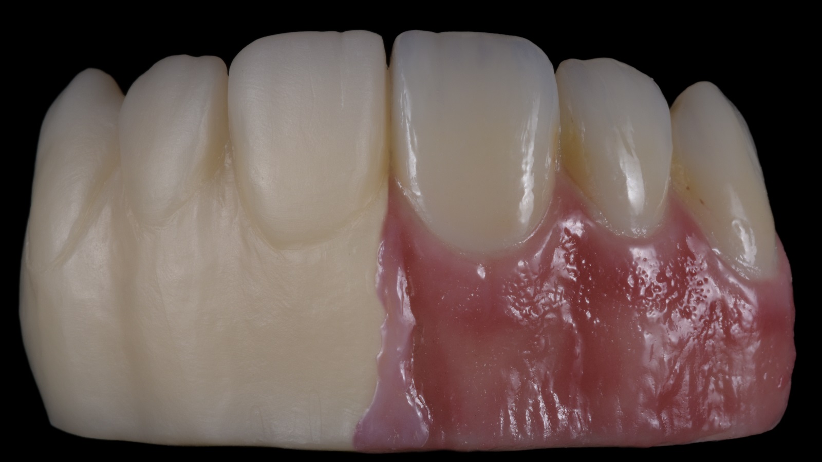 Πριν και μετά 